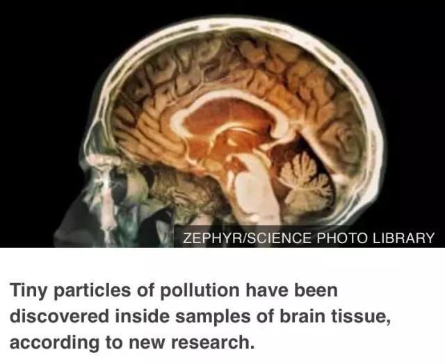 雾霾，或许不仅会损伤我们的肺，还会损伤我们的大脑。