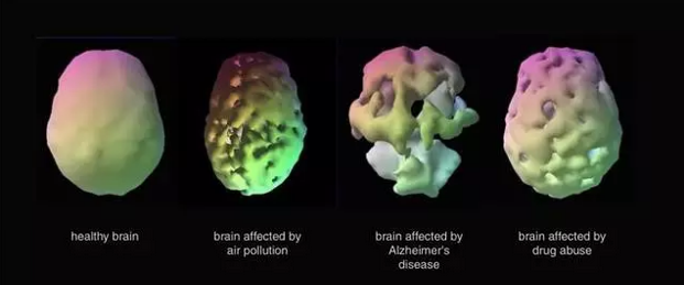 （左起图一为健康的大脑，图二三四依次为被空气污染、老年痴呆症以及毒品侵蚀的大脑）